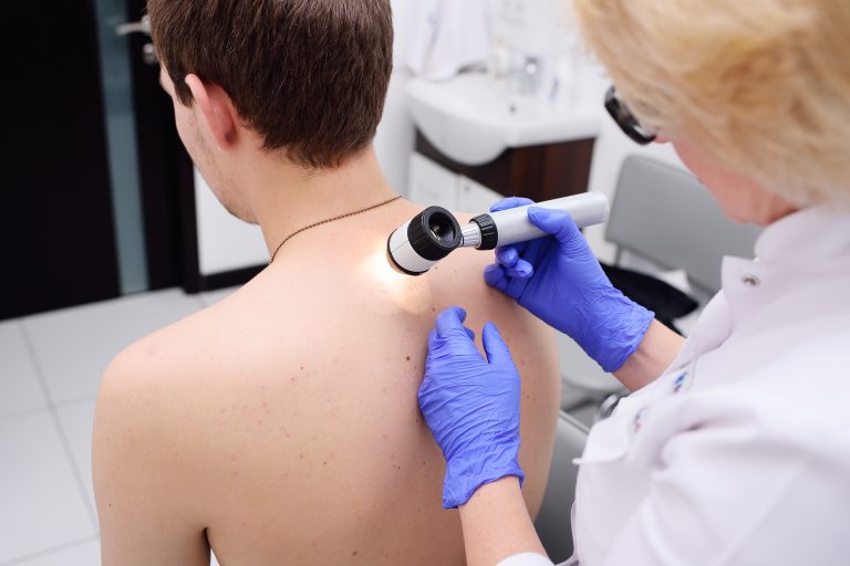 Advanced melanoma: Dual drugs increase survival of ‘untreatable’ cancer – study