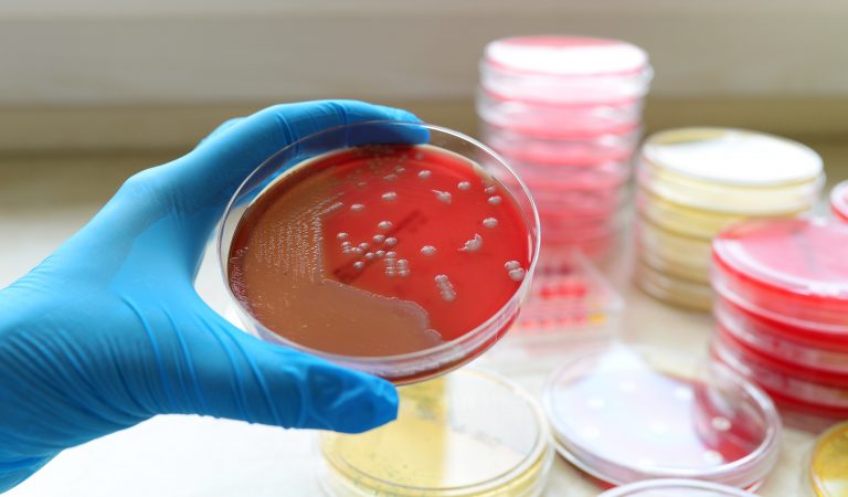 Bacterial ‘striptease’ evades antibiotics